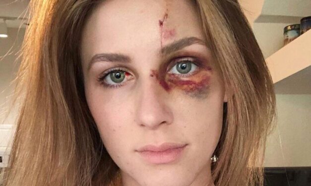 Brasileira Agredida nos EUA Permanece no País Enquanto Processo Contra o Agressor Segue na Justiça
