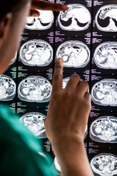 A meta da Midjourney é operar mais de 50 mil scanners no mundo até 2031