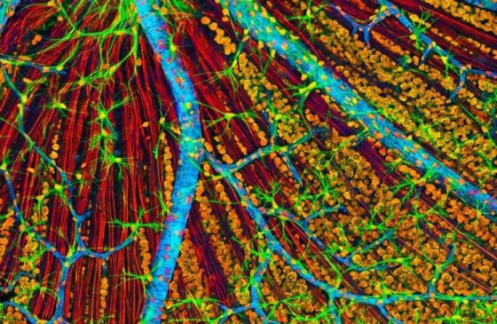 CIENTISTAS TESTAM PELA PRIMEIRA VEZ EM HUMANOS TERAPIA QUE PODE REJUVENESCER CÉLULAS ENVELHECIDAS 2 O tratamento busca fazer células envelhecidas voltarem a se comportar como células mais jovens. Thomas Deerinck, NCMIR/Science Photo Library