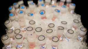 CAMBRIDGE, UNITED KINGDOM - DECEMBER 09:  Vials containing biological samples are stored on ice to keep them fresh before being analysed at the Cancer Research UK Cambridge Institute on December 9, 2014 in Cambridge, England.  Cancer Research UK is the world's leading cancer charity dedicated to saving lives through research. Its vision is to bring forward the day when all cancers are cured. They have saved millions of lives by discovering new ways to prevent, diagnose and treat cancer, and as such the survival rate in the UK has doubled in the last 40 years. Cancer Research UK funds over 4,000 scientists, doctors and nurses across the UK, more than 33,000 patients who join clinical trials each year and a further 40,000 volunteers that give their time to support the work. (Photo by Dan Kitwood/Getty Images/Cancer Research UK)