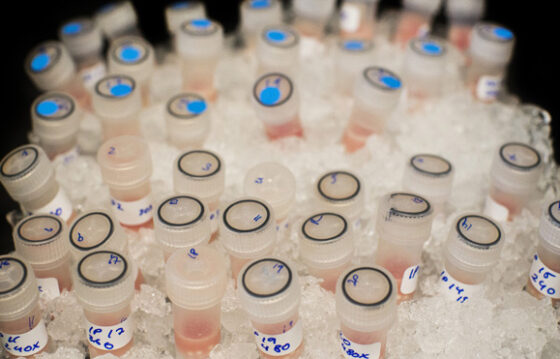 lab work e1744933828463