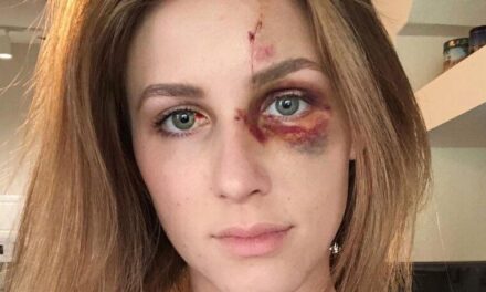 Brasileira Agredida nos EUA Permanece no País Enquanto Processo Contra o Agressor Segue na Justiça