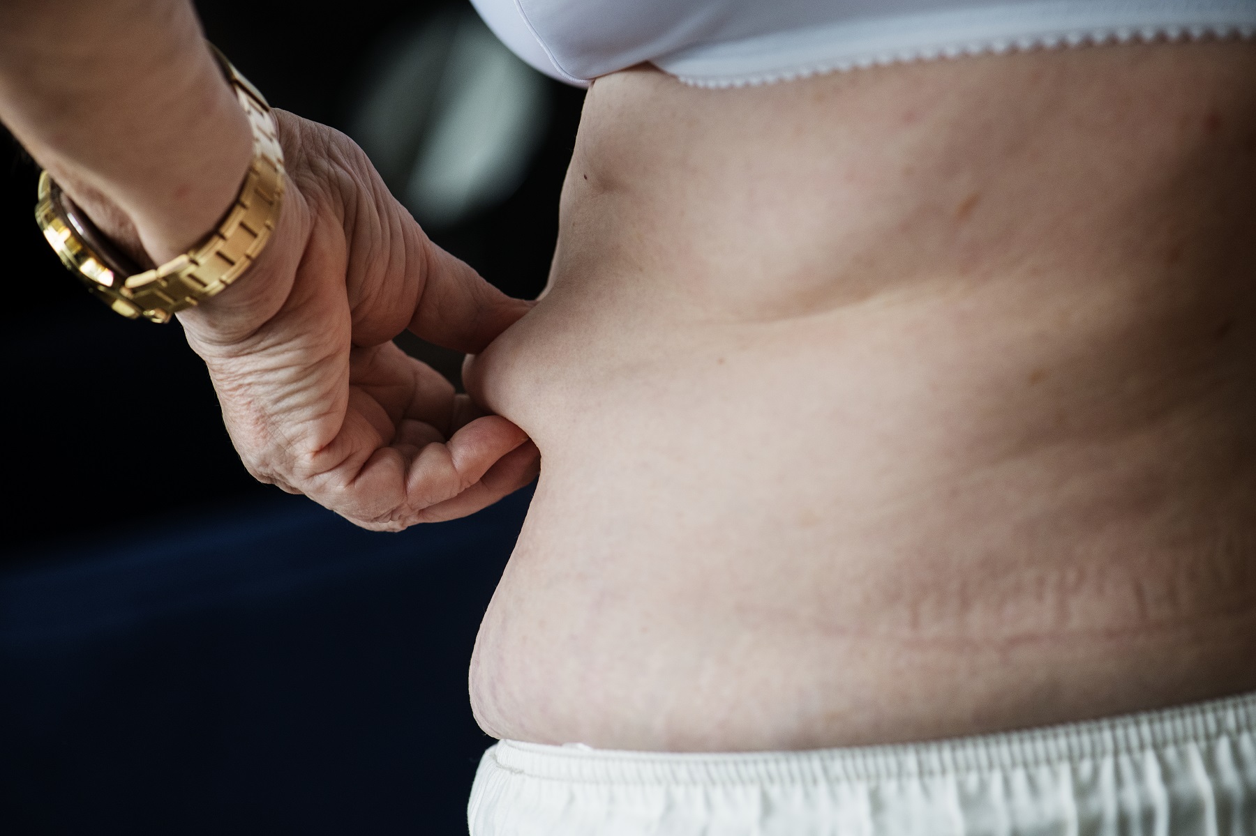 Weight Loss Myths: It Can Make you Fat